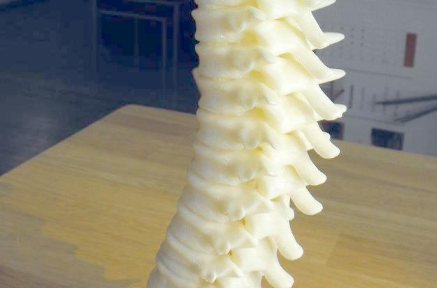 3D打印人体椎骨