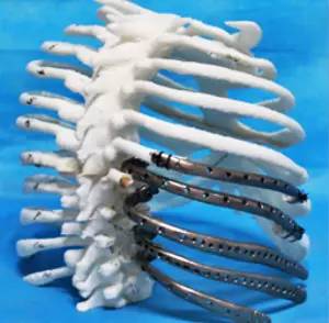 第四军医大学精彩分享个性化医疗3D打印的实战案例与研究成果