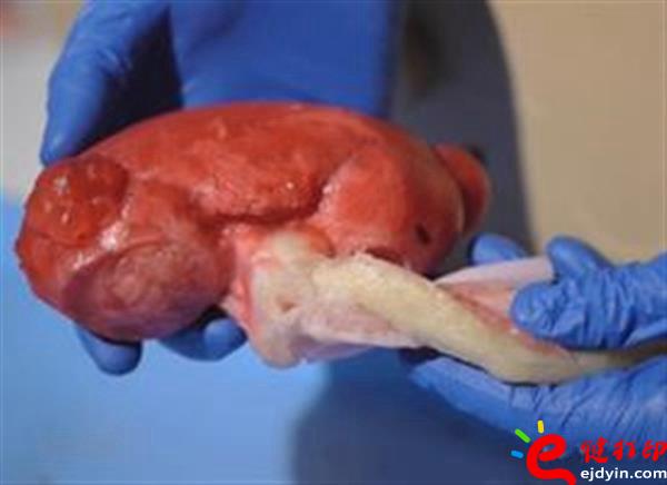 [3d打印医疗]医生手术磨刀石 仿生3D打印心脏及人体器官