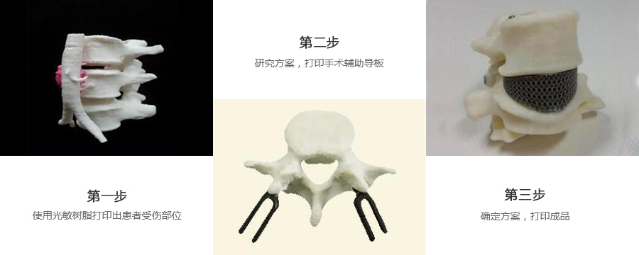 腰椎金属植入物3d打印制作流程
