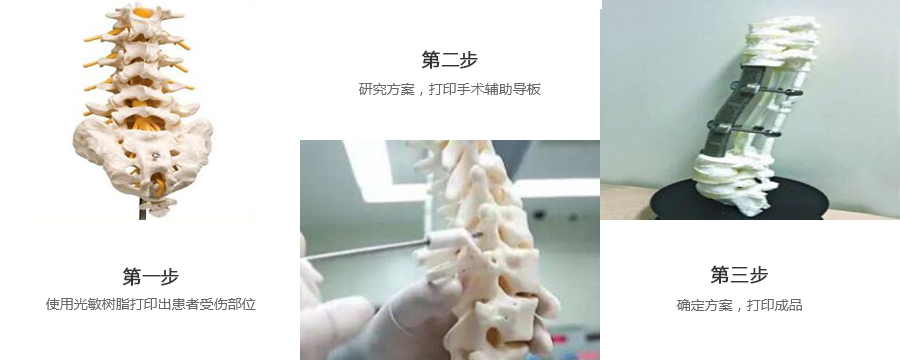 脊椎金属植入物3d打印制作流程